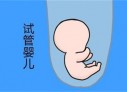 培养成都捐卵宝宝艺术细胞的小技巧